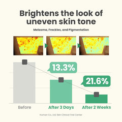 Dark Spot Correcting Glow Serum by AXIS-Y